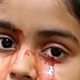 Imagen para el artículo titulado El extraño caso de una niña que sangra por los ojos entra a formar parte de la literatura médica